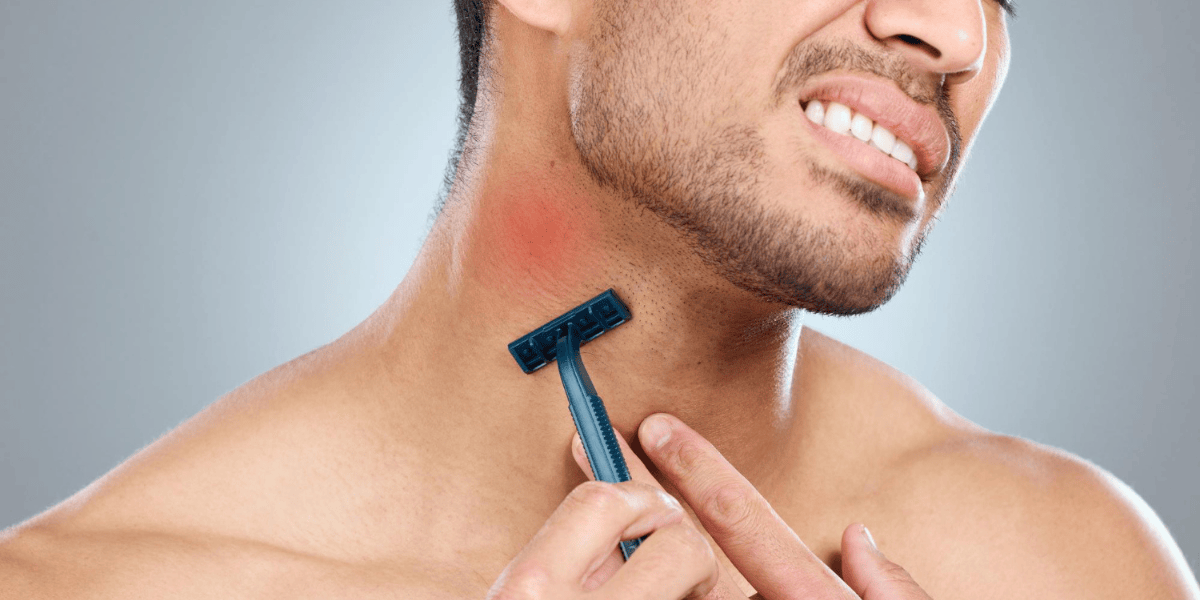 How to Avoid Razor Burn - The Complete Guide for Smooth, Irritation-Free Skin